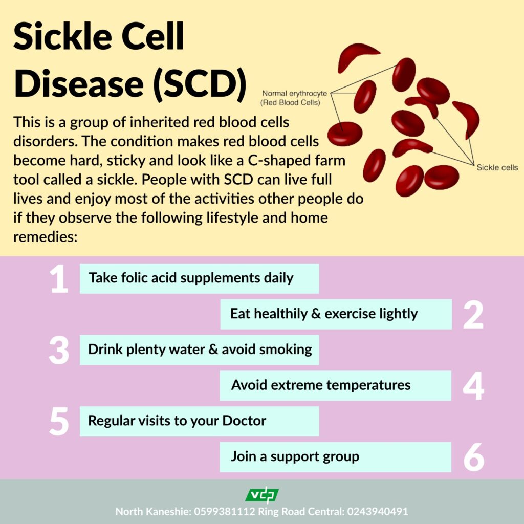 sickle cell disease management